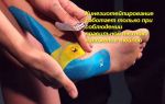 Как надо делать тейпирование стопы