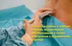 Какие уколы от радикулита вам помогут