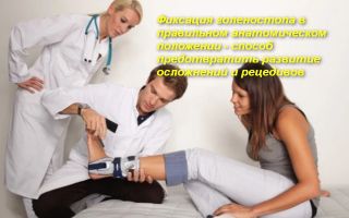 Как правильно выбрать голеностопный ортез