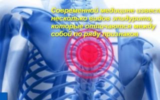 Как вылечить эпидурит позвоночника