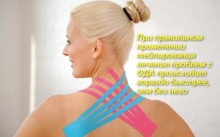 Что такое тейпирование и как работает этот метод