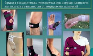 Ортез — что это и для чего нужен