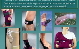 Ортез — что это и для чего нужен